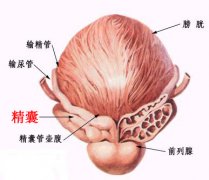 什么是慢性精囊炎